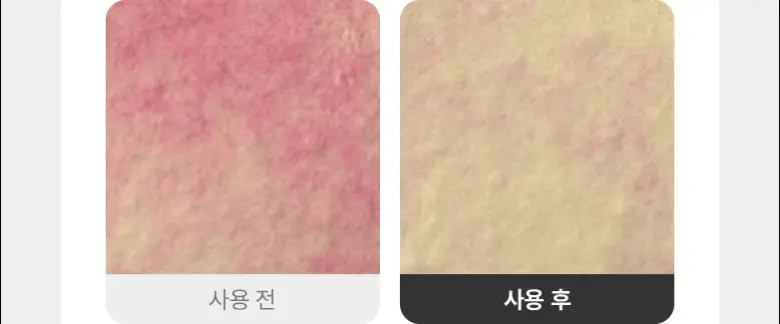 [흔적진정] 바이오힐 보 판테셀 리페어 시카좀 앰플 30ml 상세페이지 19